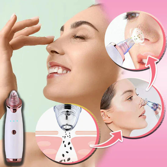 Aspirateur Pour Points Noirs